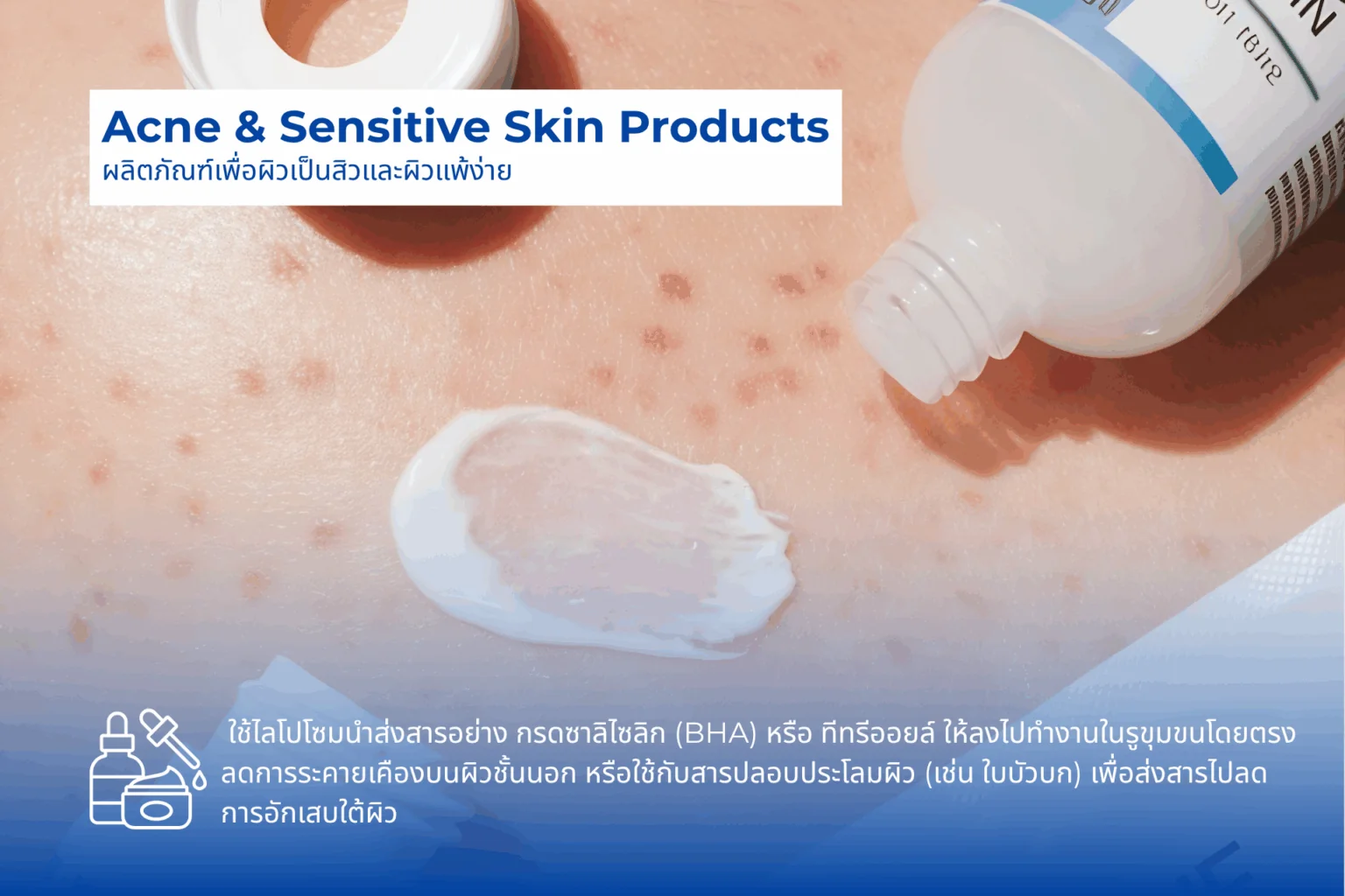 Acne & Sensitive Skin Products: Describing liposomes delivering ingredients like Salicylic Acid (BHA) or soothing agents to reduce inflammation.